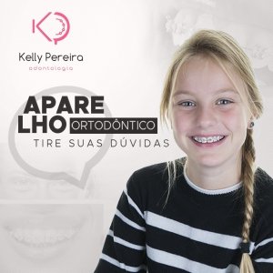 Tudo que você precisa saber, objetivamente, sobre os aparelhos ortodônticos